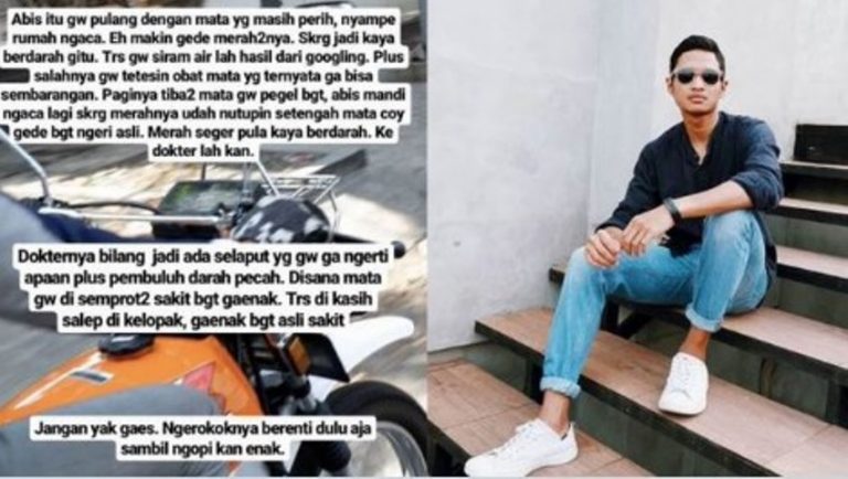 Sakit mata terkena abu rokok oleh pengendara motor kondisinya memprihatinkan